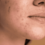 How to Build a Skincare Routine for Oily Skin