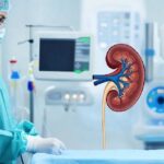 Kidney Transplant