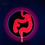 colon ct scan